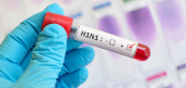 آنفلوانزای H۱N۱؛ مهمان جدید بیمارستان های ساوه