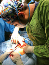 جراحی توده بدخیم اندام برای اولین بار در ساوه